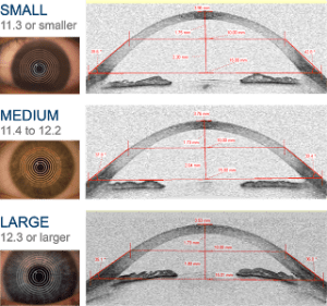 corneal_diameters