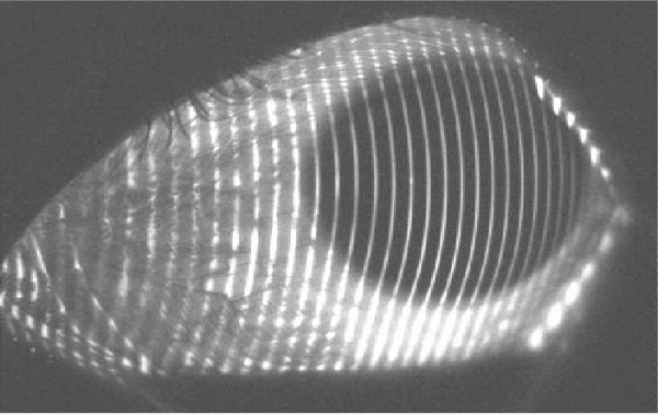 Evolution of Scleral Lens Fitting