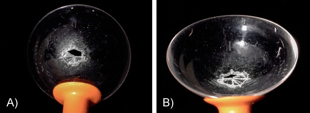 Broken Scleral Lens