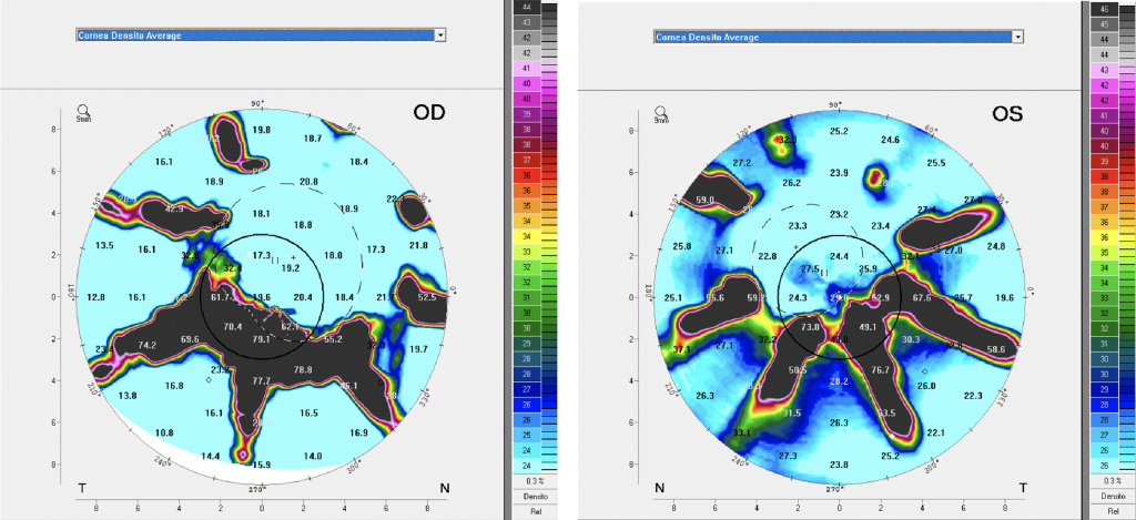 Density Average maps 